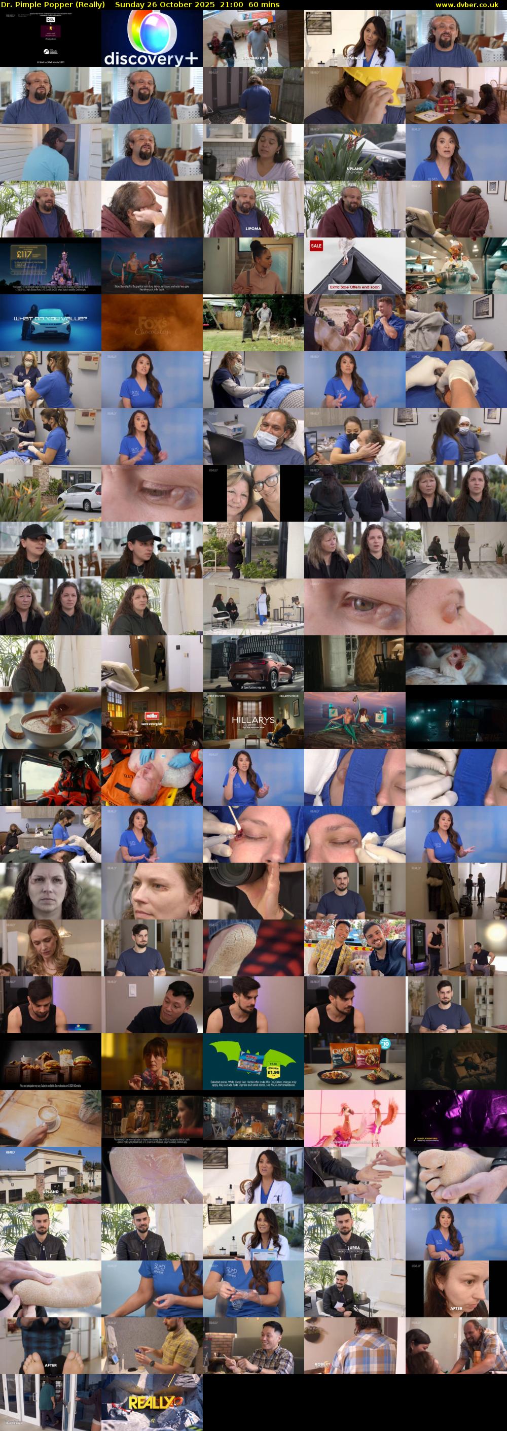 Dr. Pimple Popper (Really) Sunday 26 October 2025 21:00 - 22:00