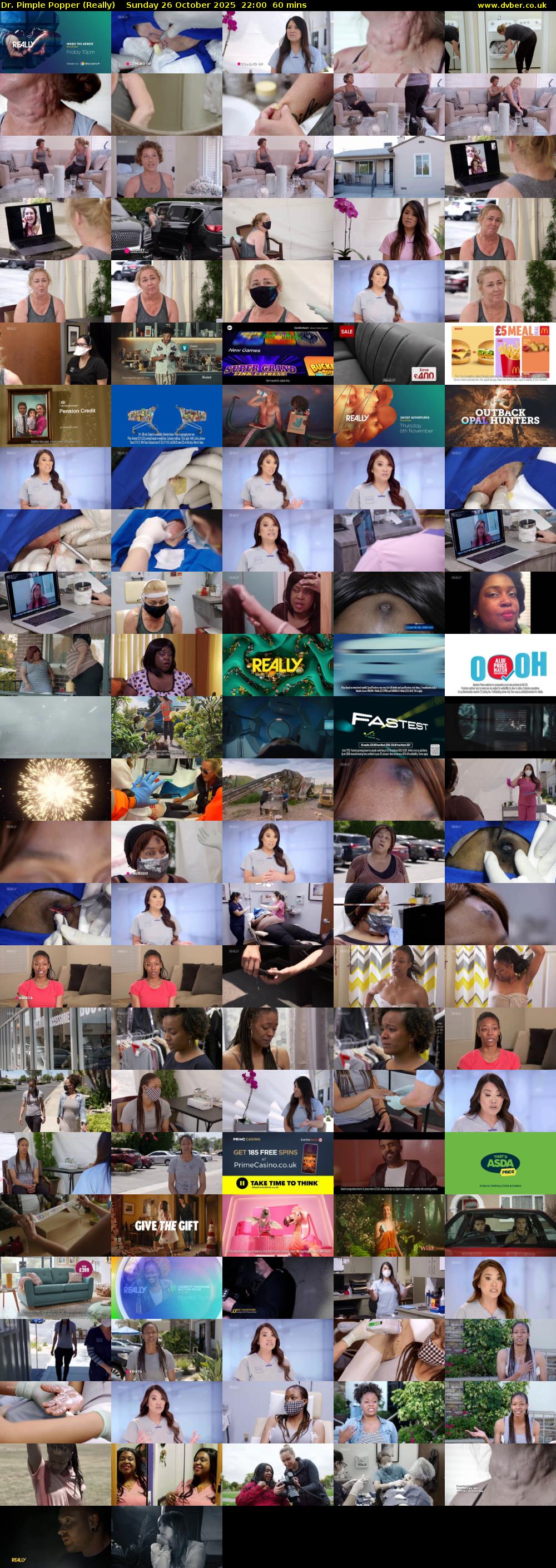 Dr. Pimple Popper (Really) Sunday 26 October 2025 22:00 - 23:00