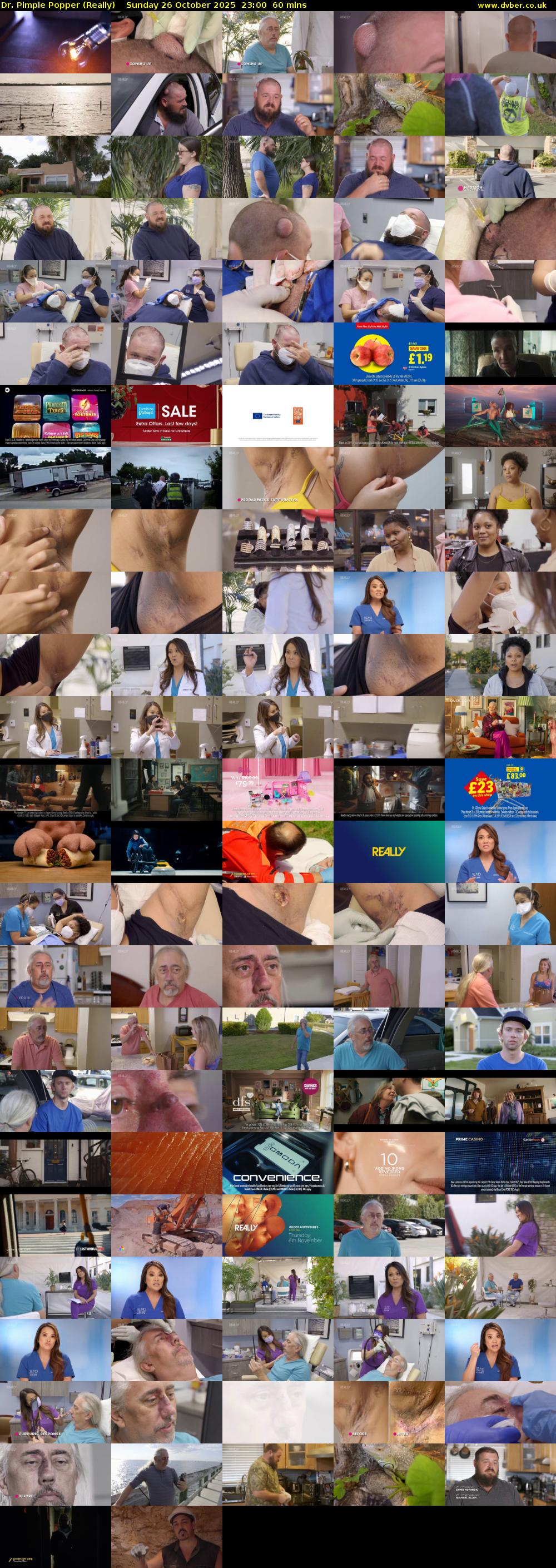 Dr. Pimple Popper (Really) Sunday 26 October 2025 23:00 - 00:00