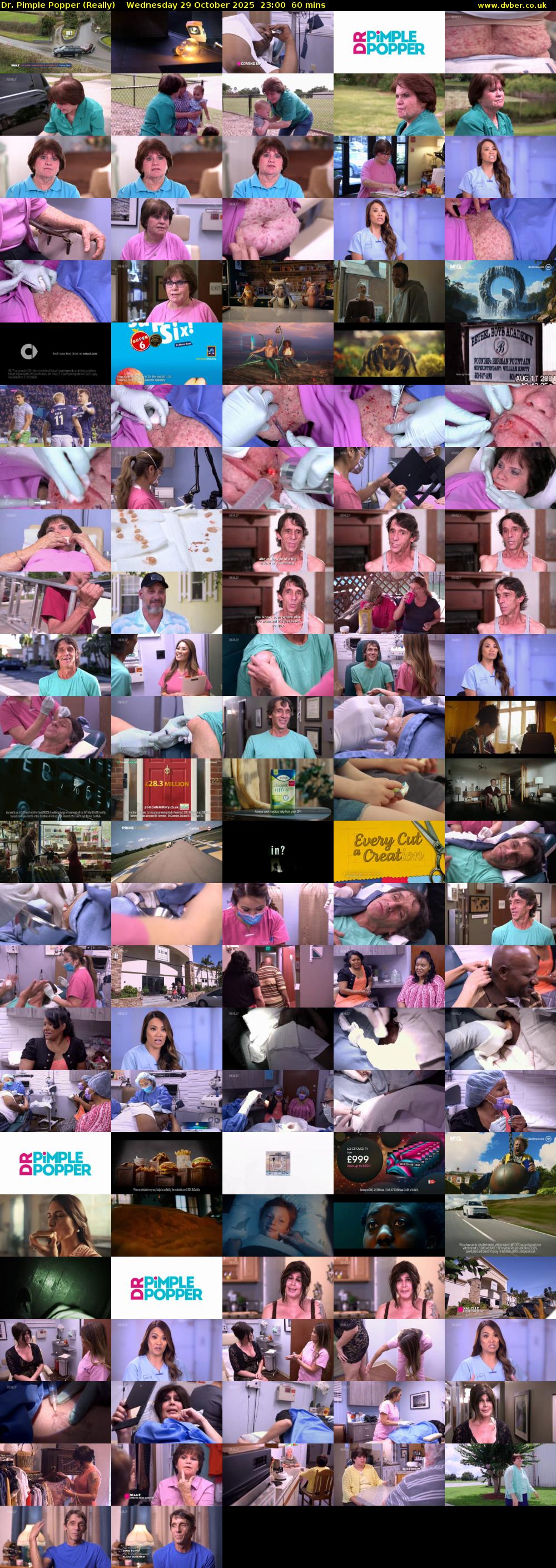 Dr. Pimple Popper (Really) Wednesday 29 October 2025 23:00 - 00:00