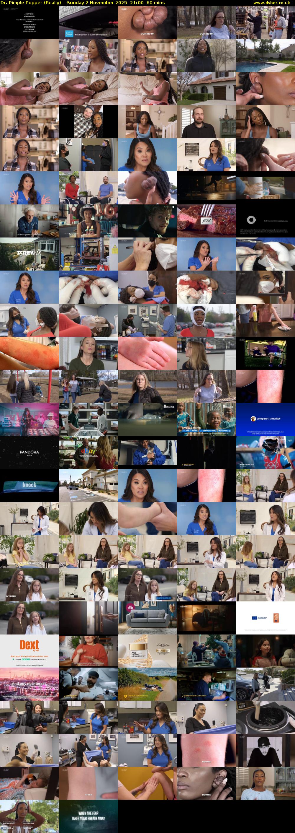 Dr. Pimple Popper (Really) Sunday 2 November 2025 21:00 - 22:00