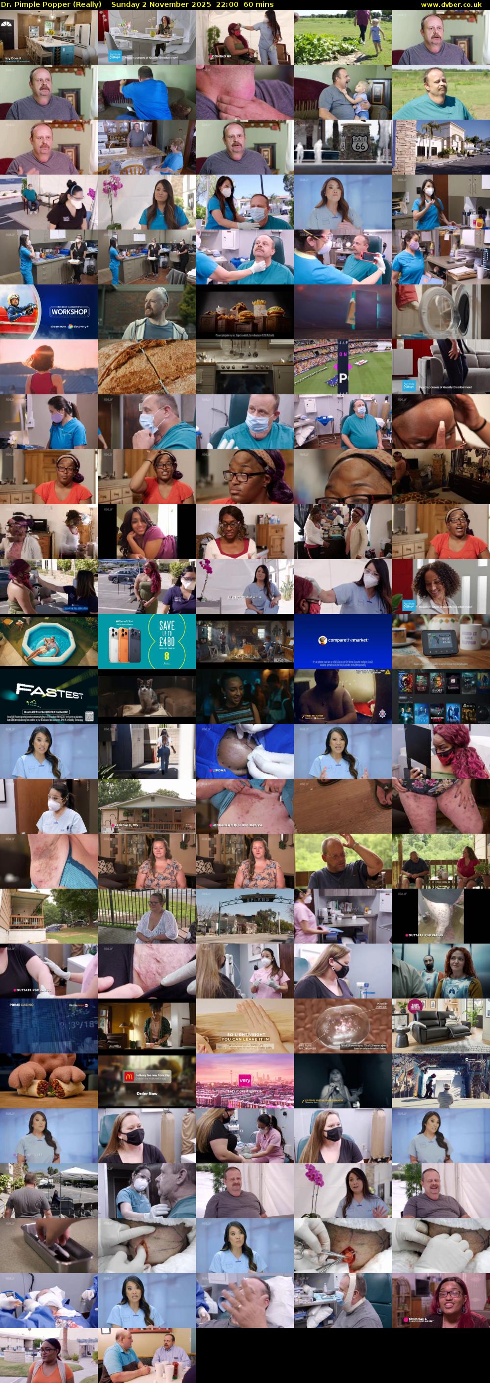 Dr. Pimple Popper (Really) Sunday 2 November 2025 22:00 - 23:00