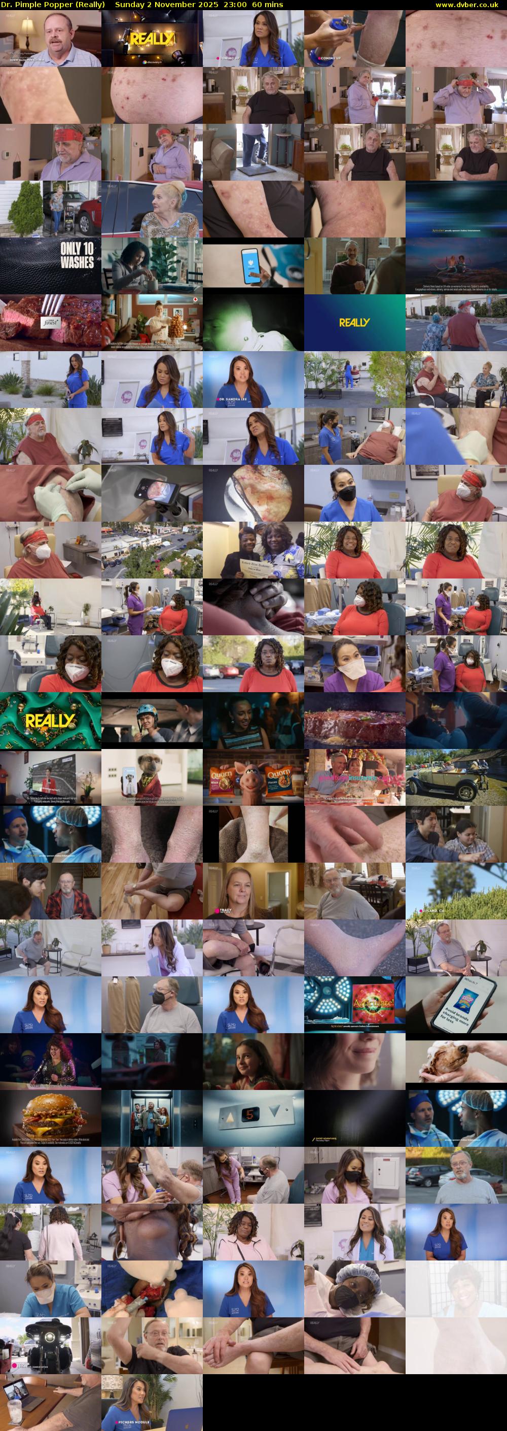 Dr. Pimple Popper (Really) Sunday 2 November 2025 23:00 - 00:00
