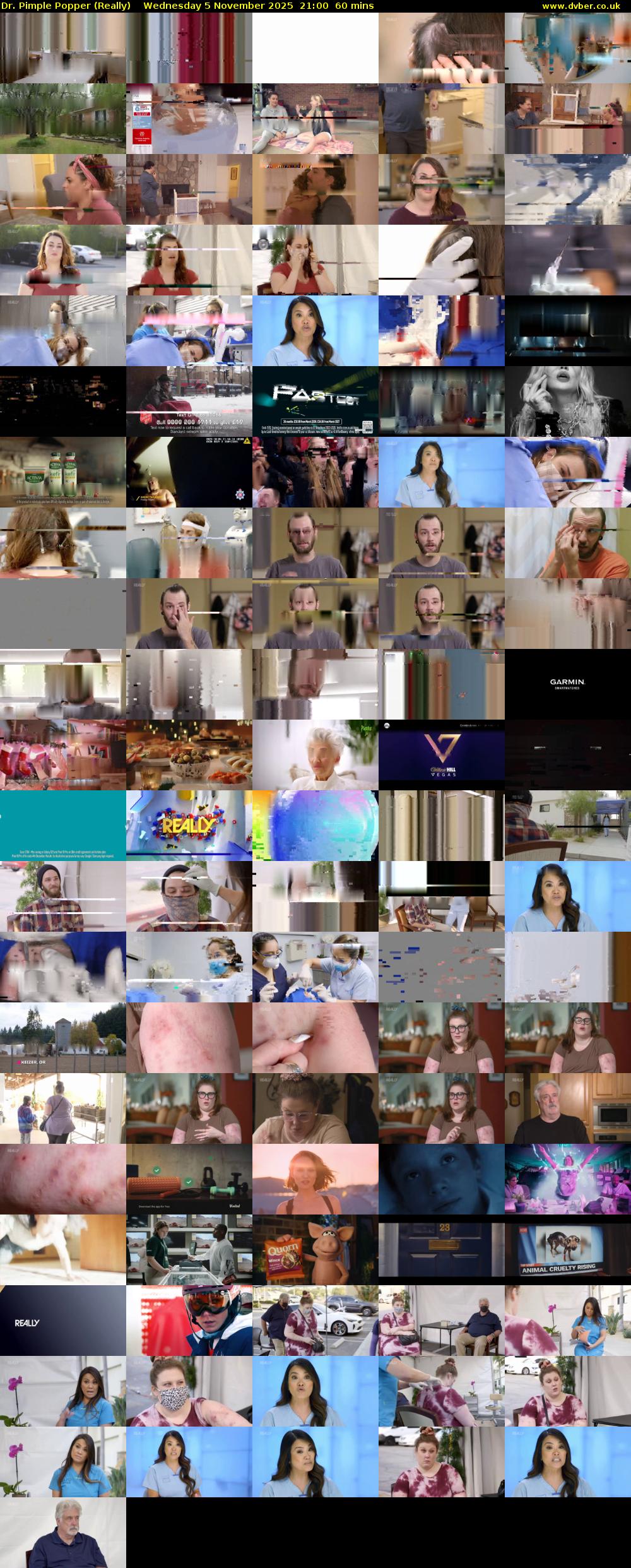 Dr. Pimple Popper (Really) Wednesday 5 November 2025 21:00 - 22:00