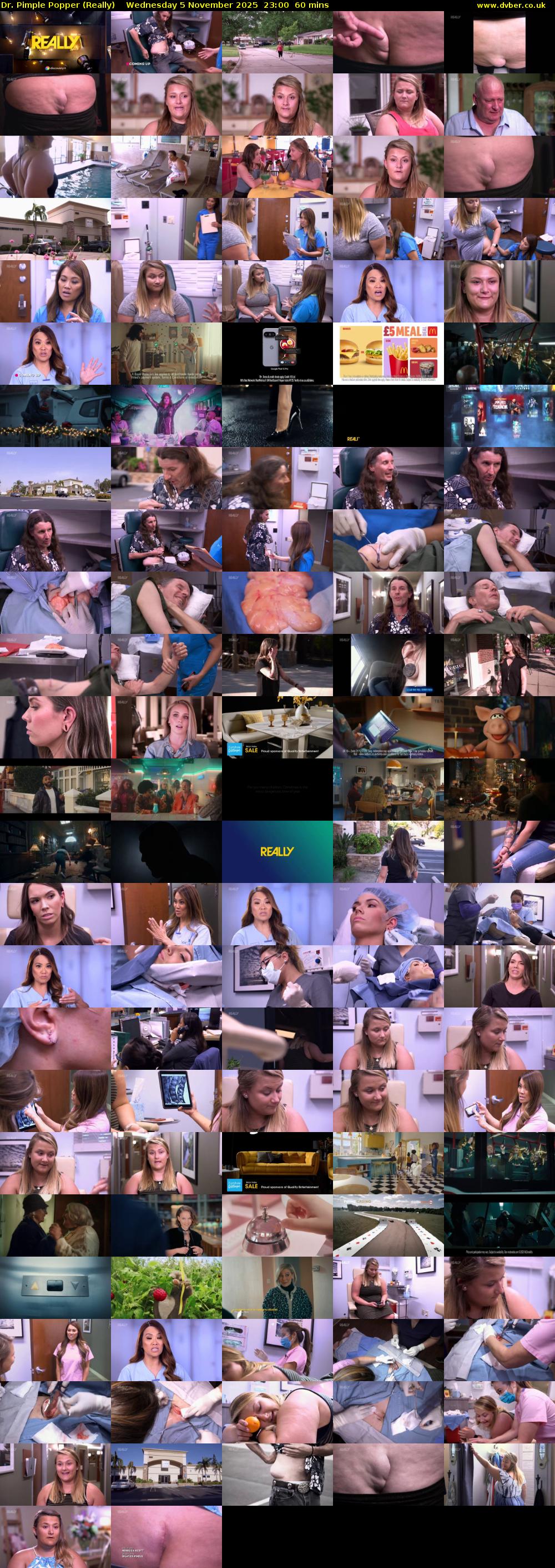 Dr. Pimple Popper (Really) Wednesday 5 November 2025 23:00 - 00:00