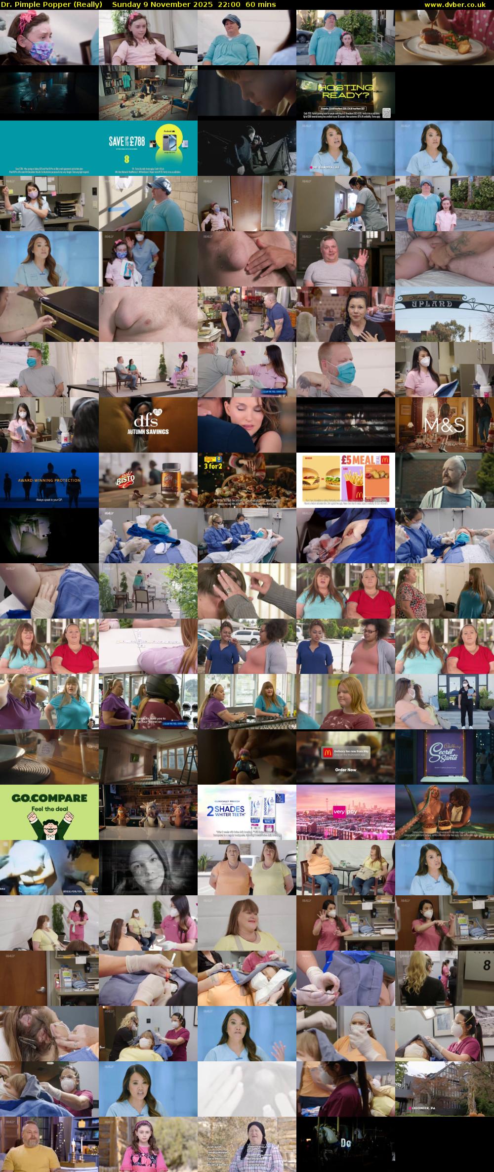 Dr. Pimple Popper (Really) Sunday 9 November 2025 22:00 - 23:00
