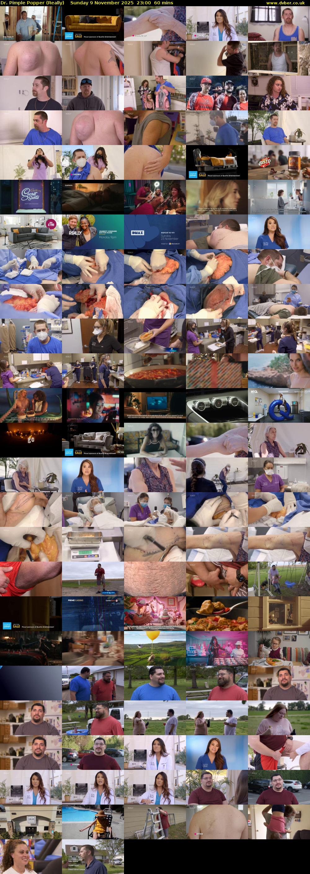 Dr. Pimple Popper (Really) Sunday 9 November 2025 23:00 - 00:00