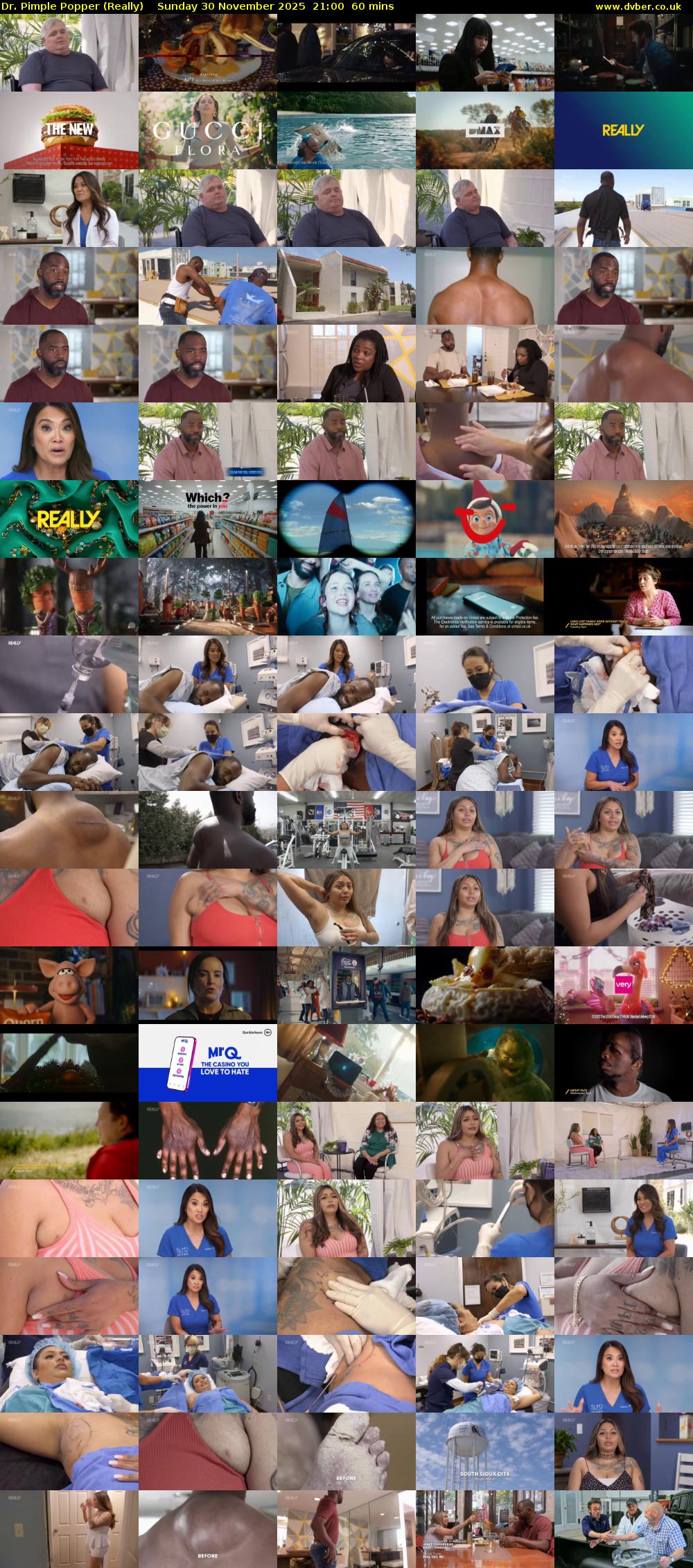 Dr. Pimple Popper (Really) Sunday 30 November 2025 21:00 - 22:00