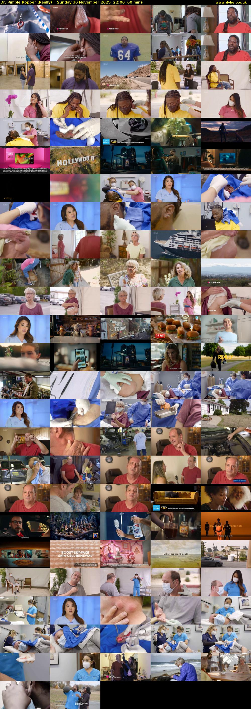 Dr. Pimple Popper (Really) Sunday 30 November 2025 22:00 - 23:00