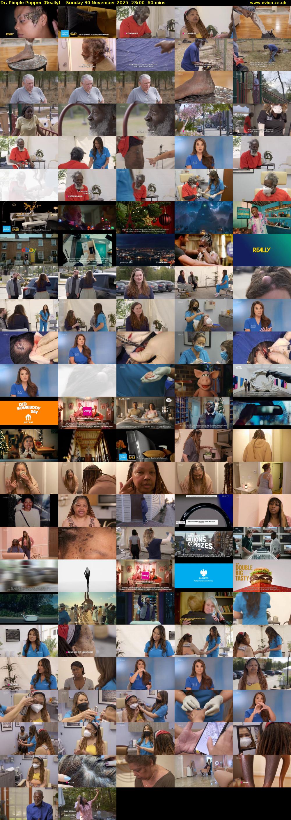 Dr. Pimple Popper (Really) Sunday 30 November 2025 23:00 - 00:00