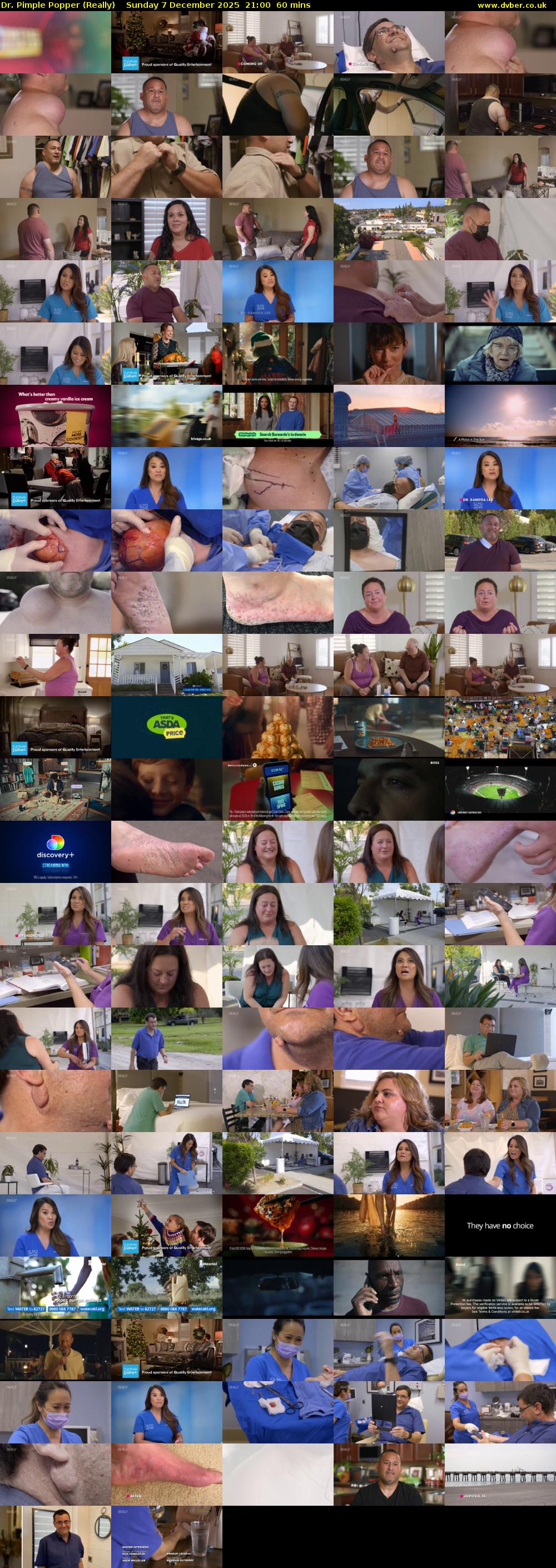 Dr. Pimple Popper (Really) Sunday 7 December 2025 21:00 - 22:00