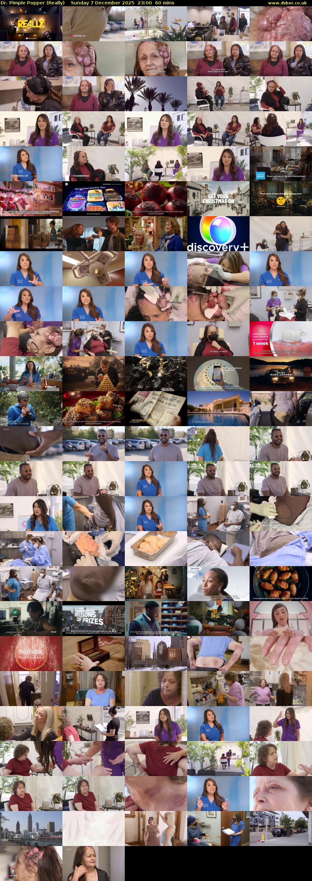 Dr. Pimple Popper (Really) Sunday 7 December 2025 23:00 - 00:00