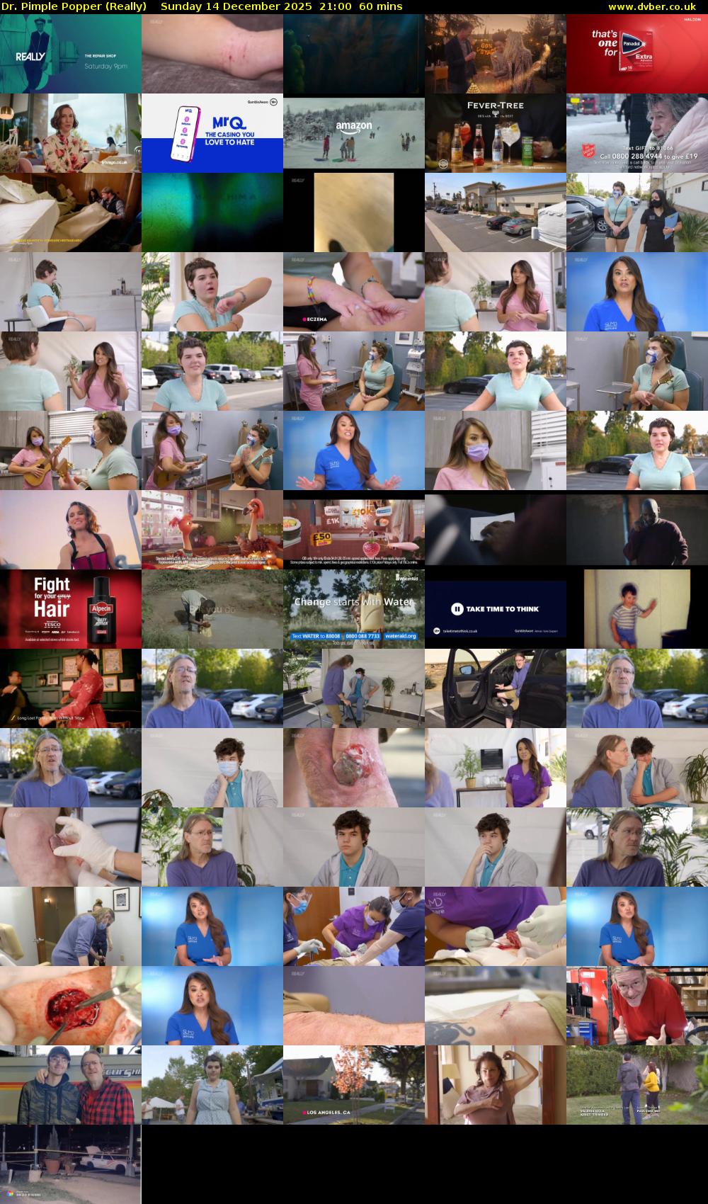 Dr. Pimple Popper (Really) Sunday 14 December 2025 21:00 - 22:00