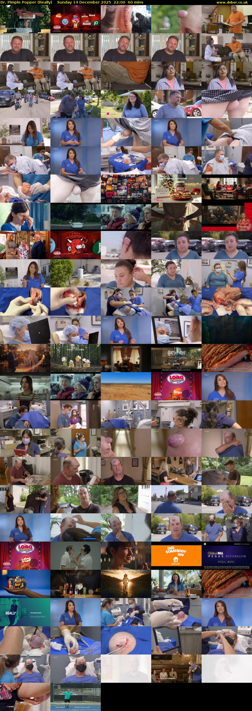 Dr. Pimple Popper (Really) Sunday 14 December 2025 22:00 - 23:00