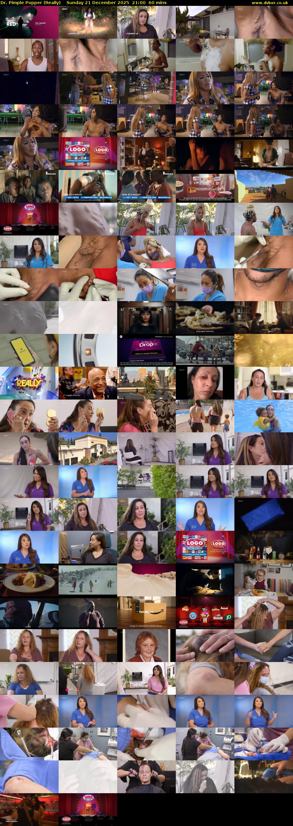 Dr. Pimple Popper (Really) Sunday 21 December 2025 21:00 - 22:00