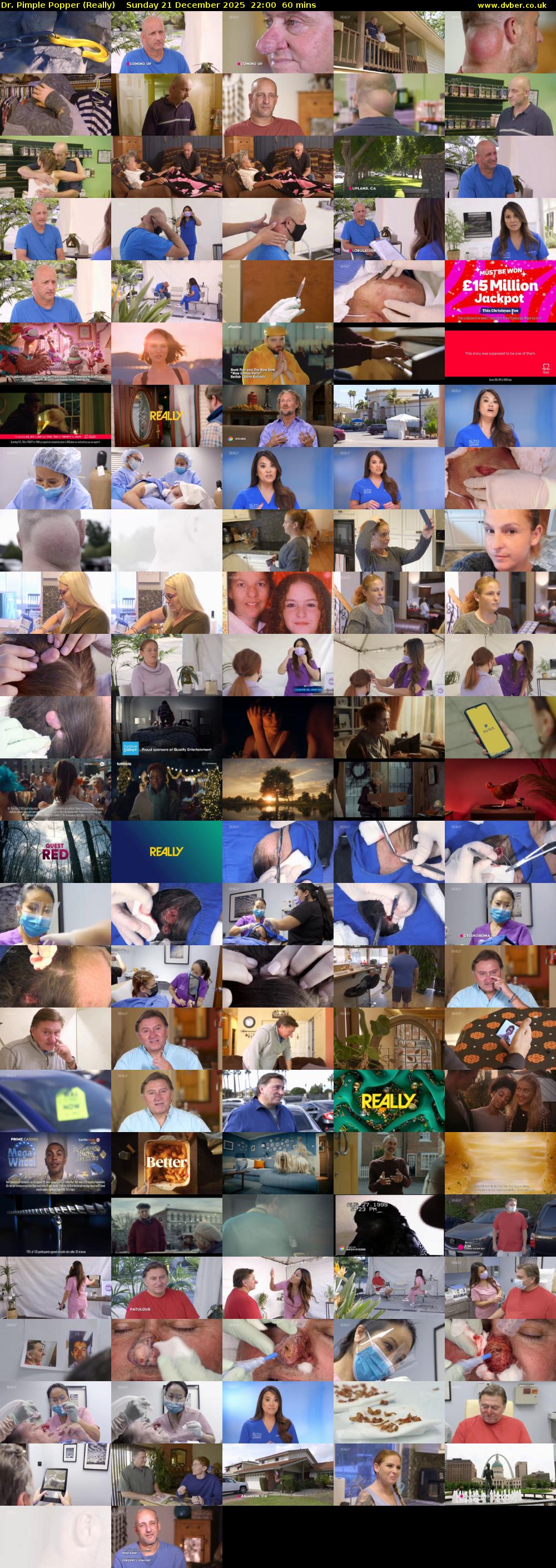 Dr. Pimple Popper (Really) Sunday 21 December 2025 22:00 - 23:00