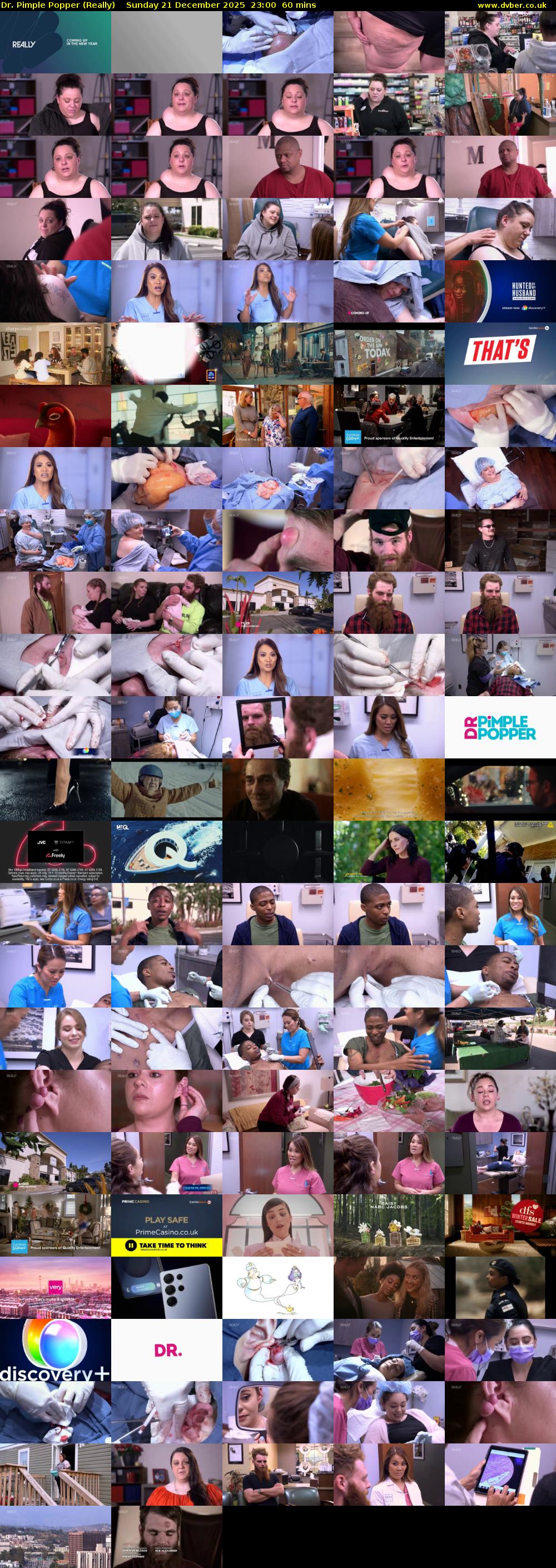 Dr. Pimple Popper (Really) Sunday 21 December 2025 23:00 - 00:00