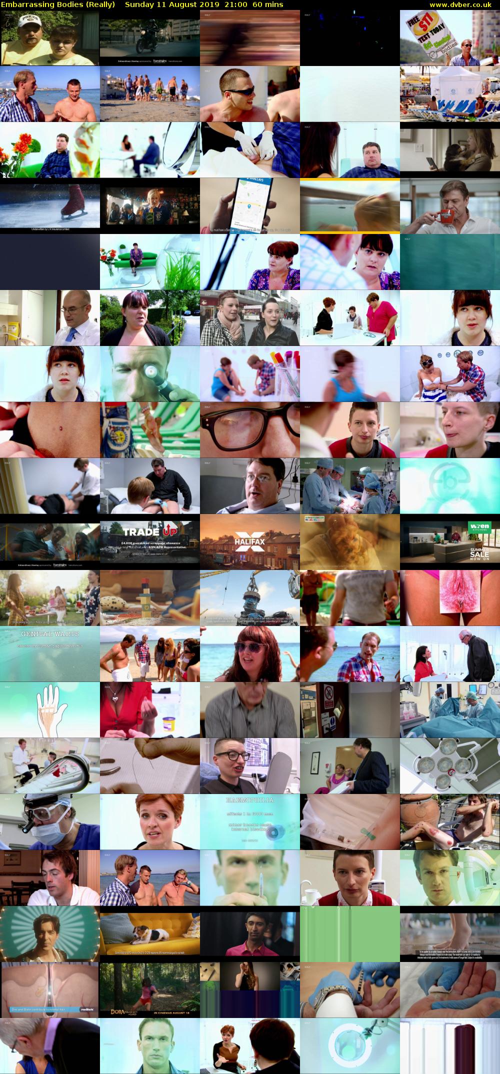 Embarrassing Bodies (Really) Sunday 11 August 2019 21:00 - 22:00