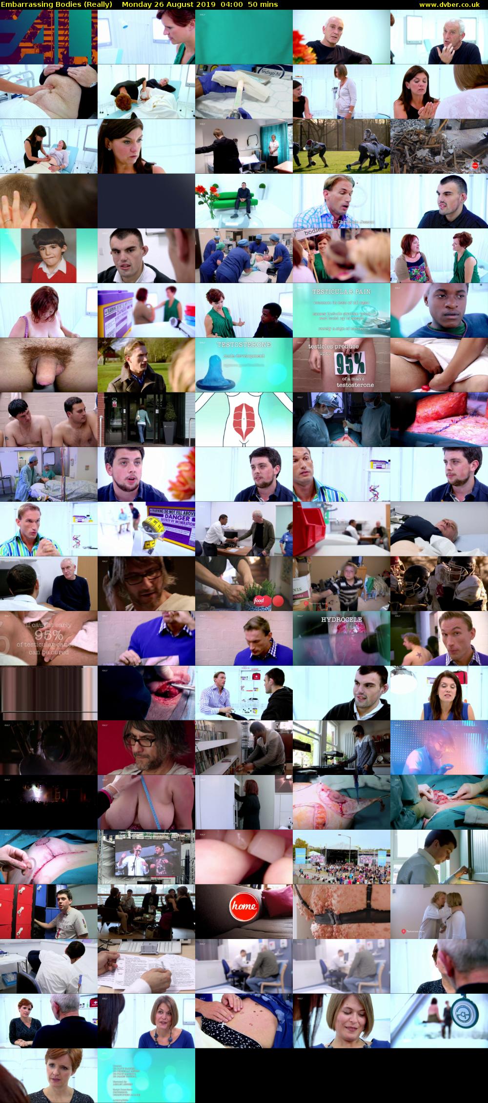 Embarrassing Bodies (Really) Monday 26 August 2019 04:00 - 04:50