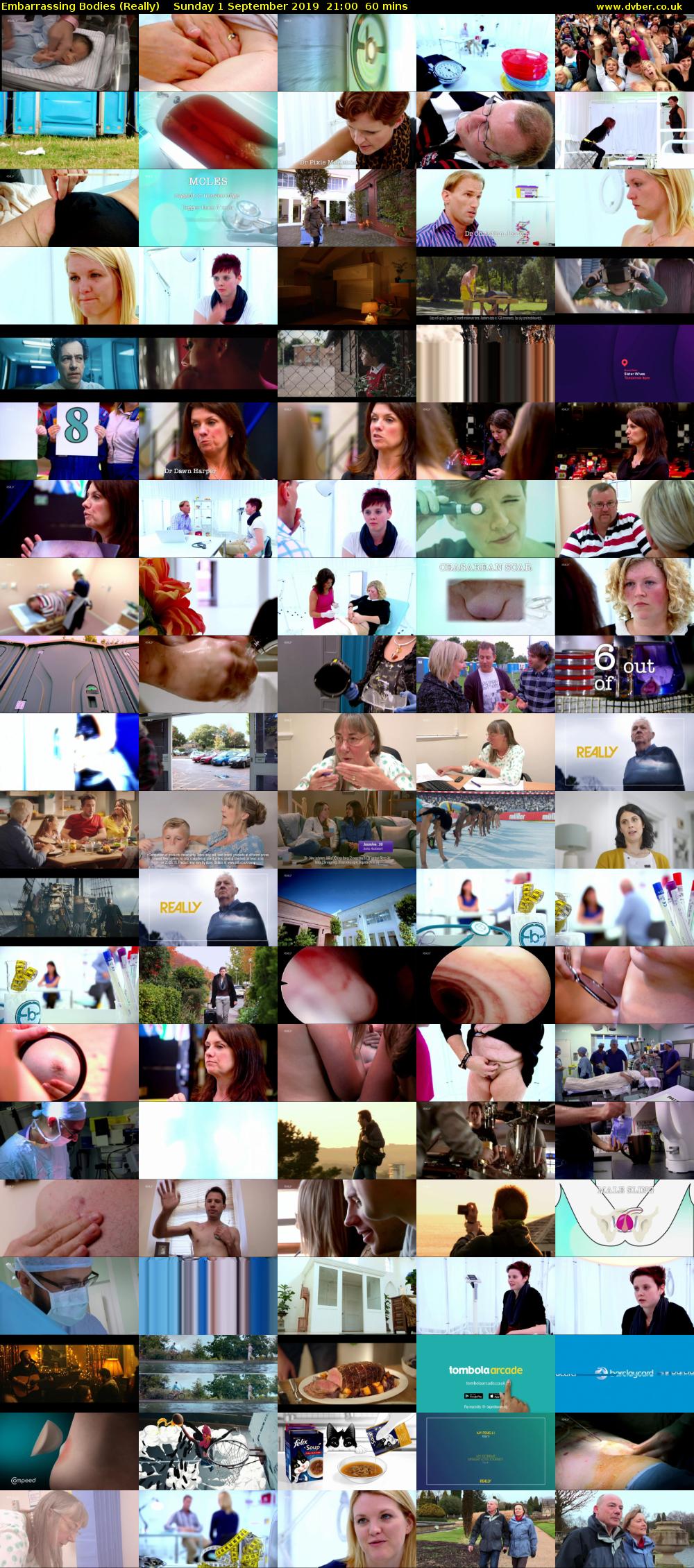 Embarrassing Bodies (Really) Sunday 1 September 2019 21:00 - 22:00