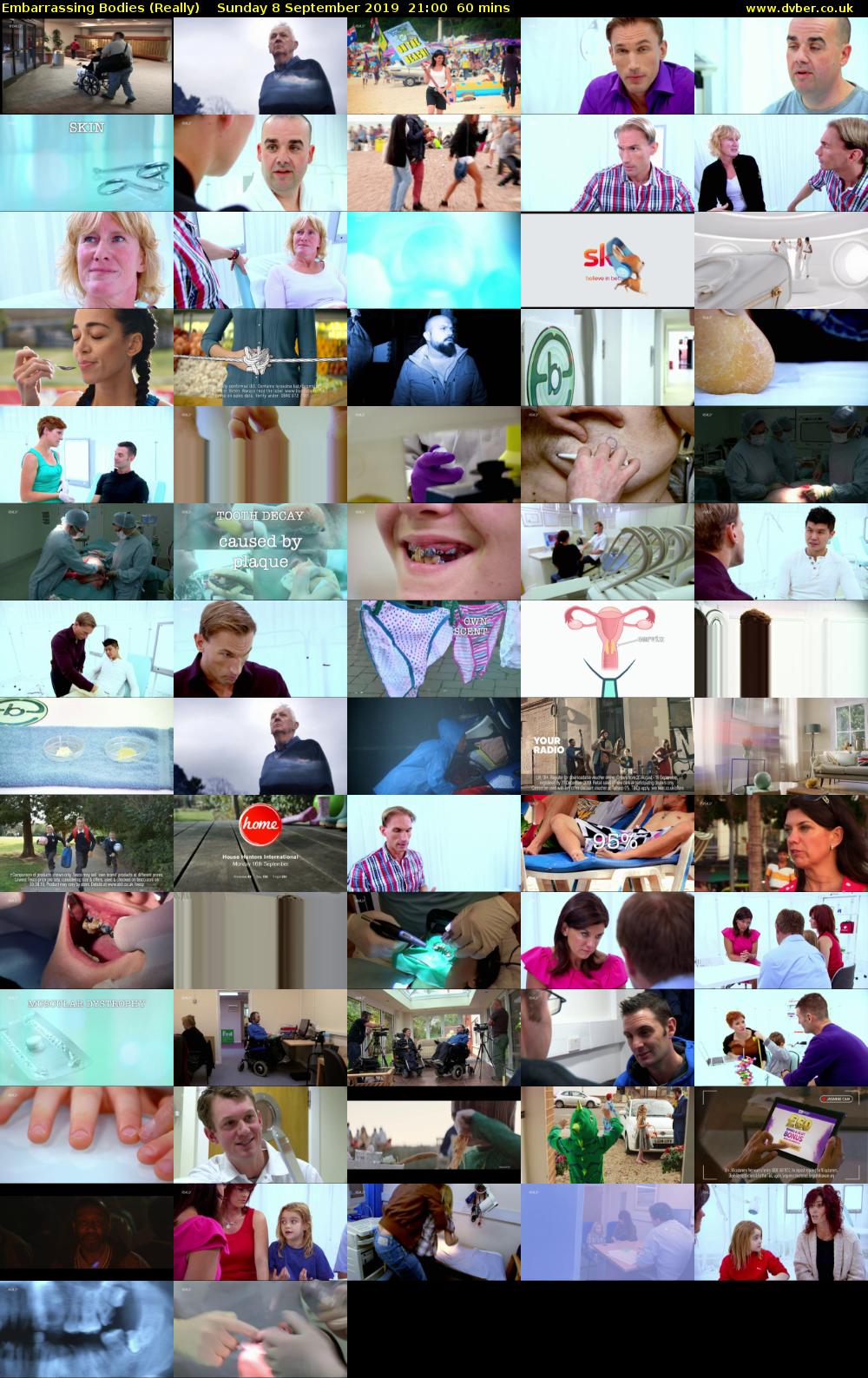 Embarrassing Bodies (Really) Sunday 8 September 2019 21:00 - 22:00