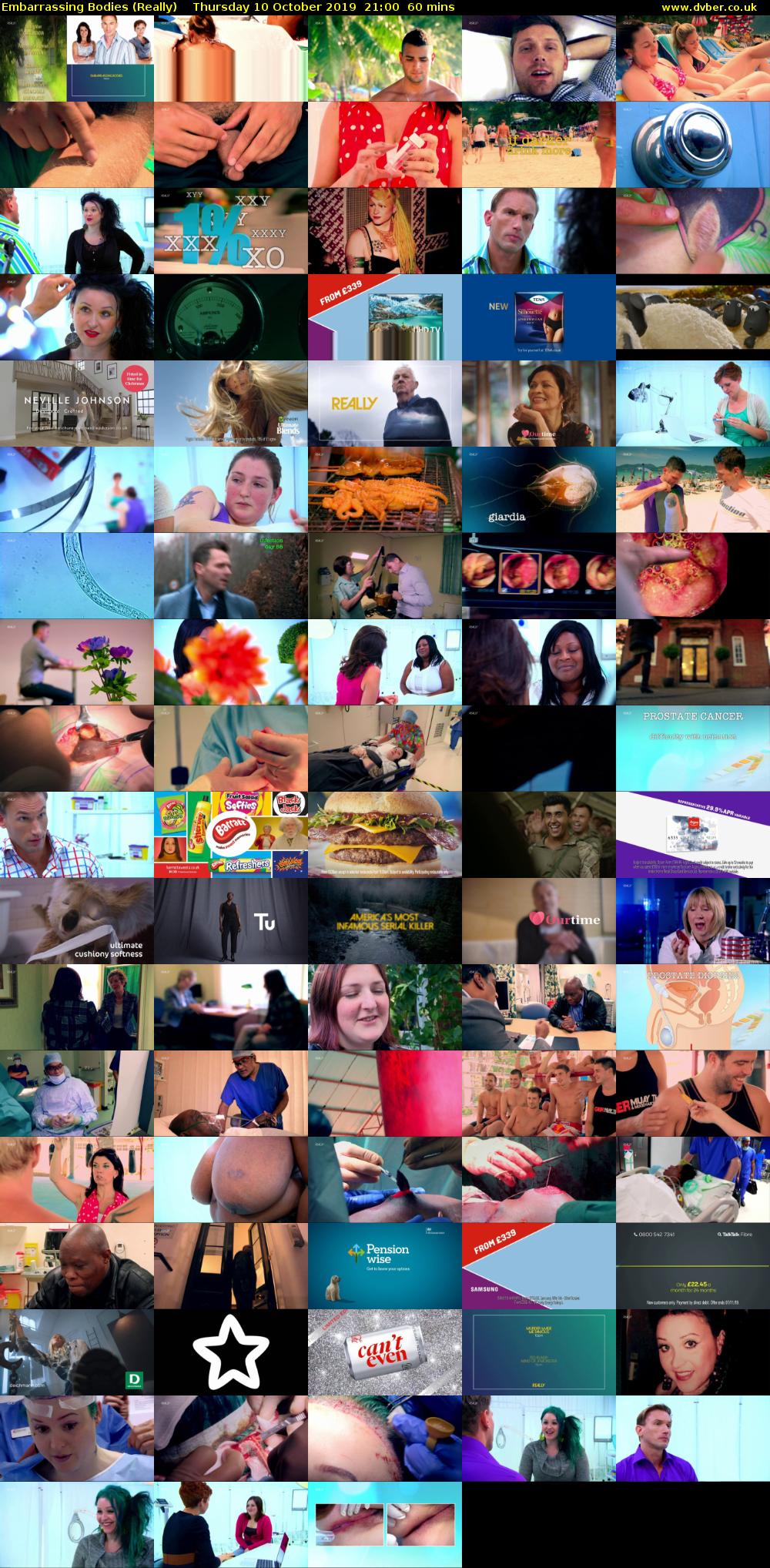 Embarrassing Bodies (Really) Thursday 10 October 2019 21:00 - 22:00