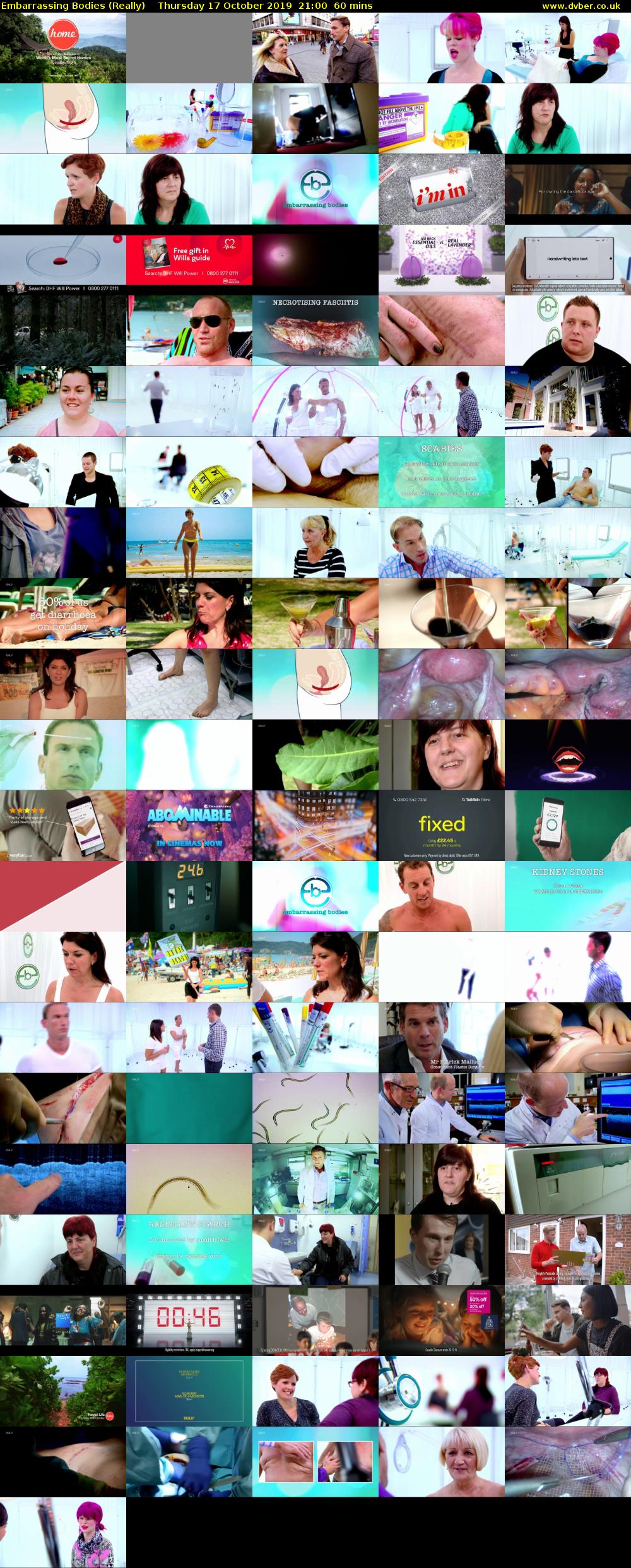 Embarrassing Bodies (Really) Thursday 17 October 2019 21:00 - 22:00