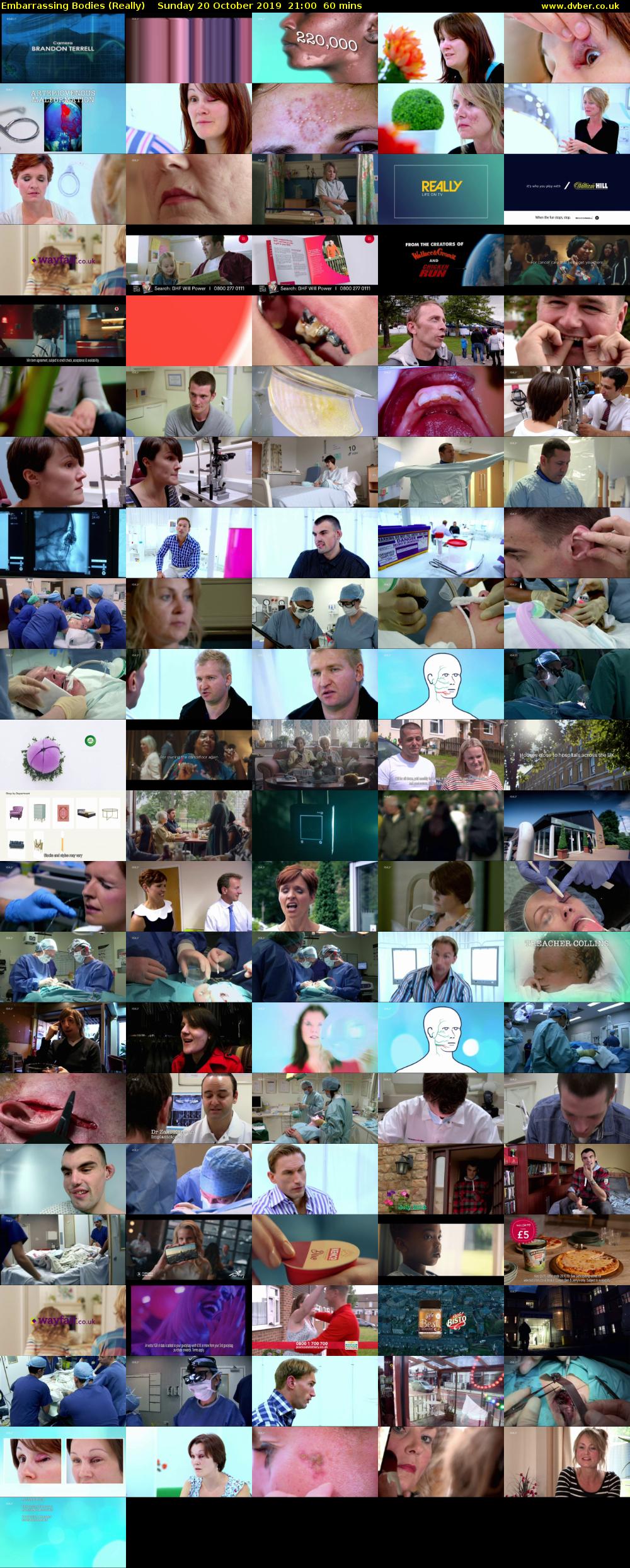 Embarrassing Bodies (Really) Sunday 20 October 2019 21:00 - 22:00