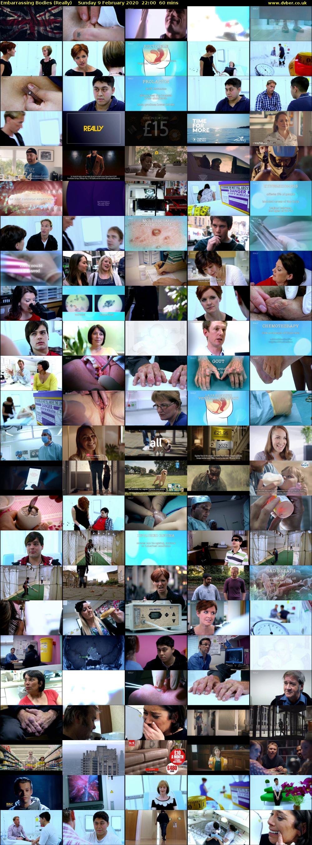 Embarrassing Bodies (Really) Sunday 9 February 2020 22:00 - 23:00
