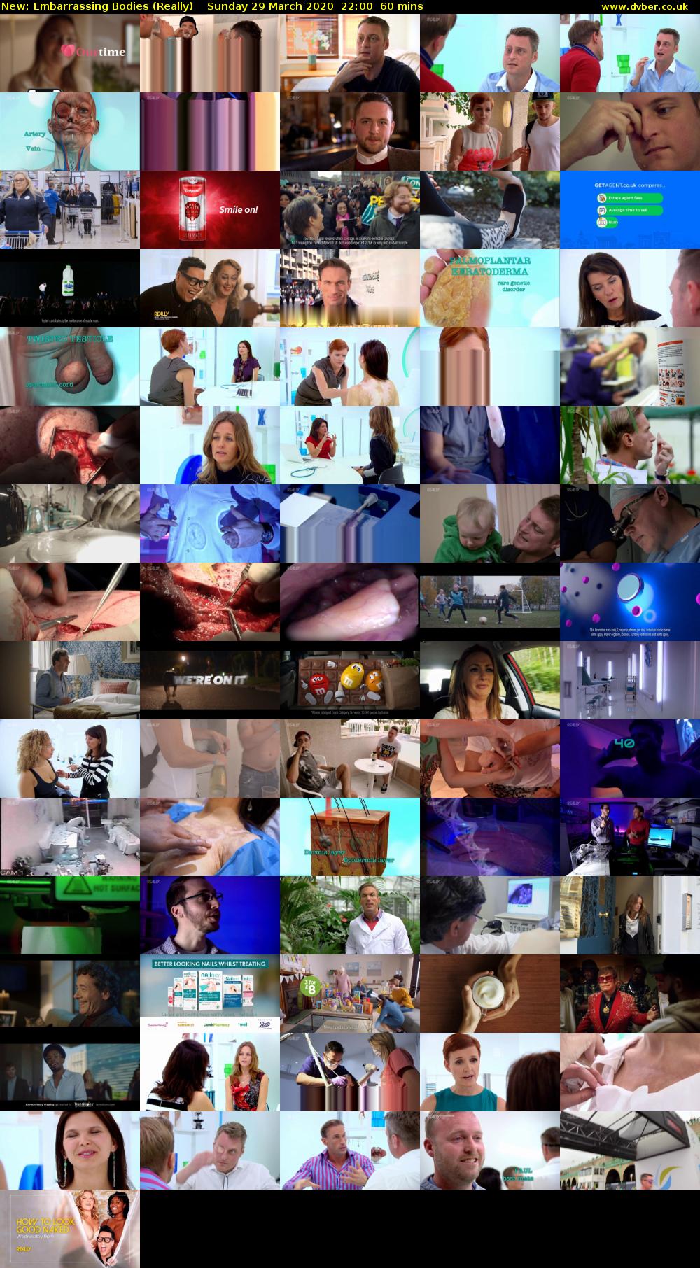 Embarrassing Bodies (Really) Sunday 29 March 2020 22:00 - 23:00