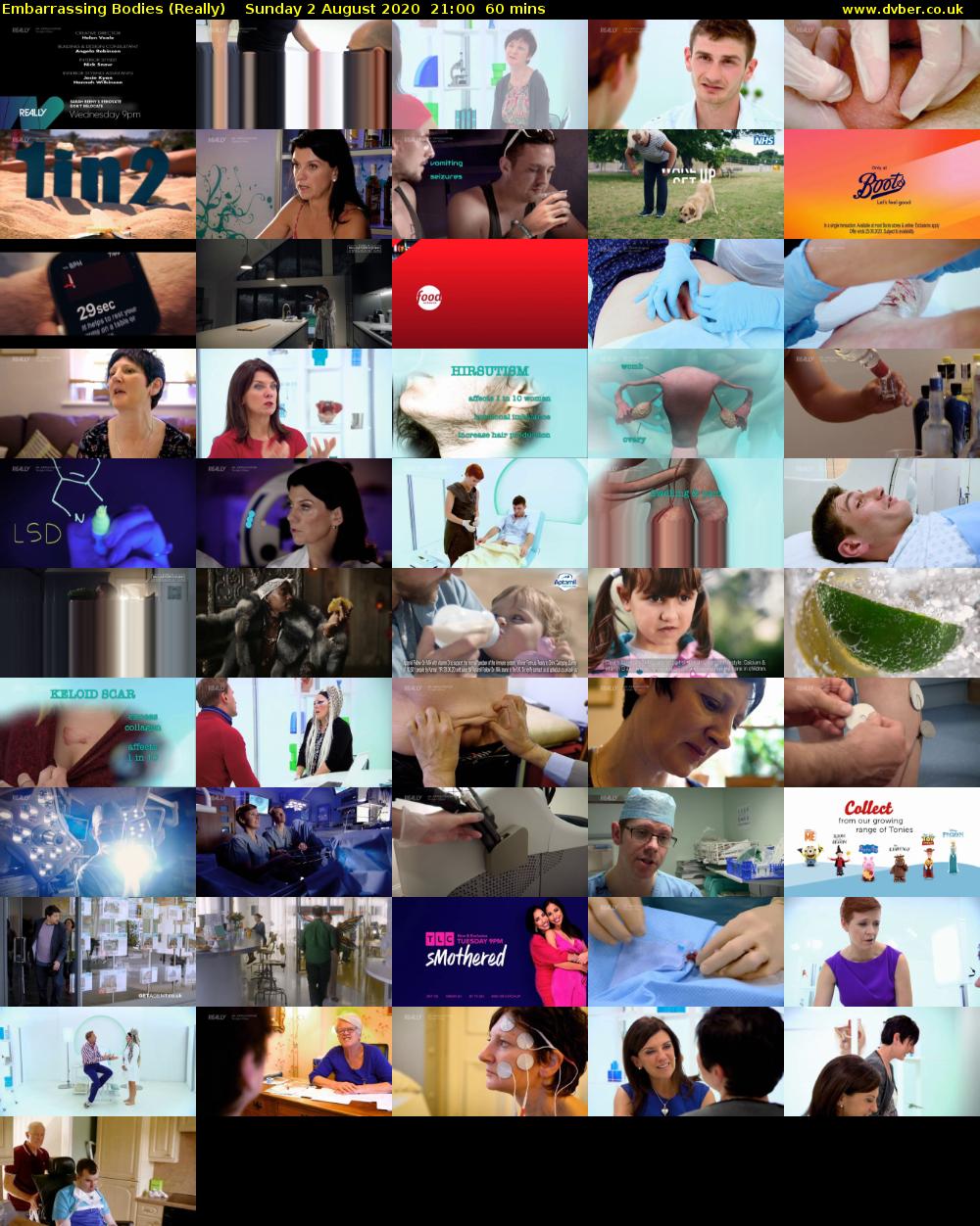 Embarrassing Bodies (Really) Sunday 2 August 2020 21:00 - 22:00
