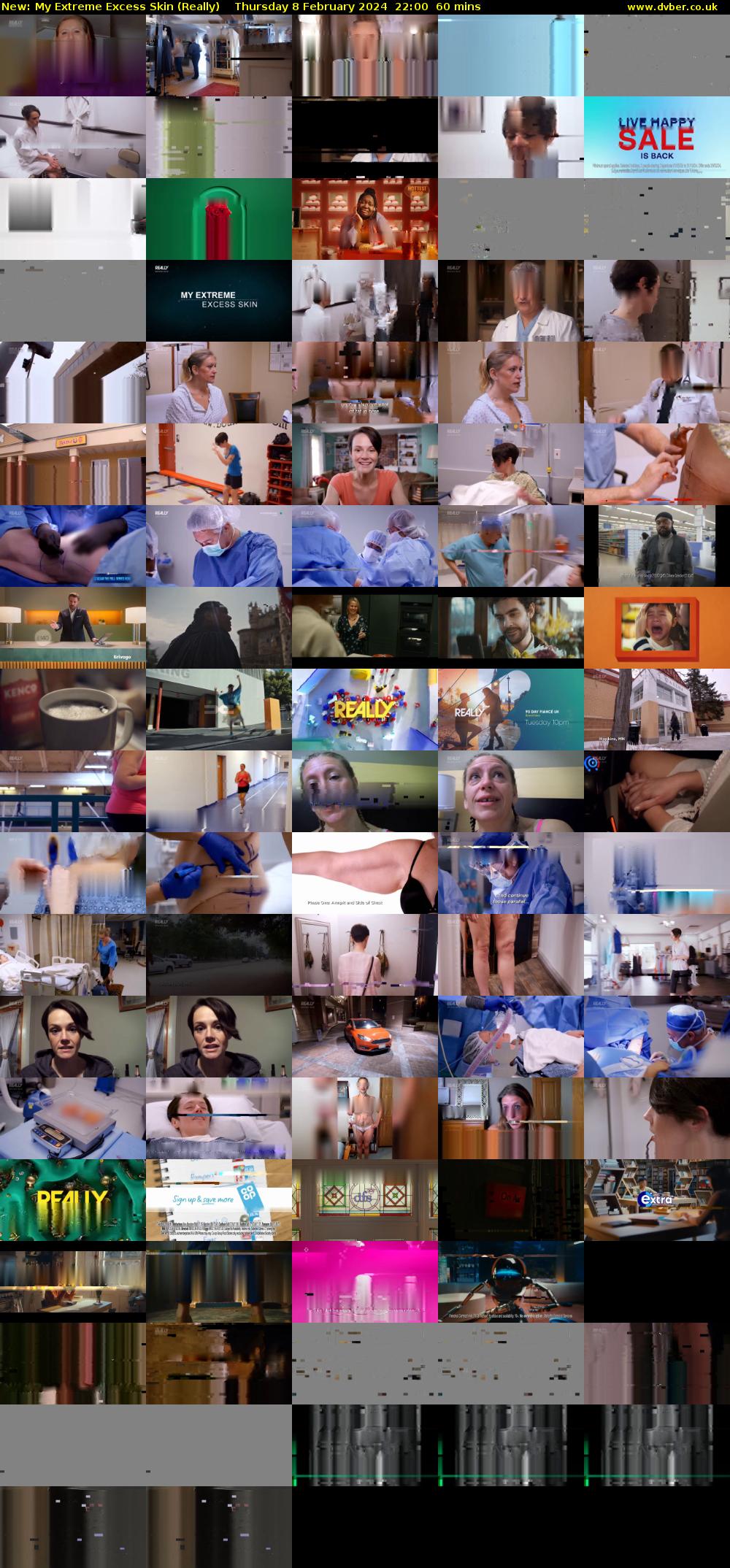My Extreme Excess Skin (Really) Thursday 8 February 2024 22:00 - 23:00