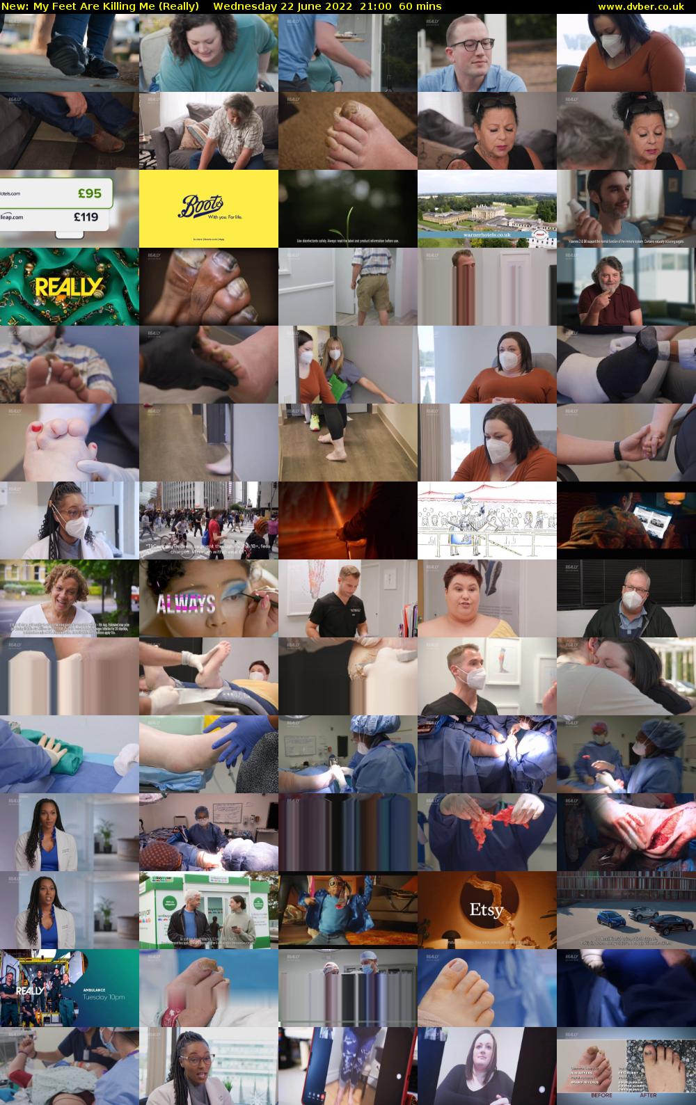 My Feet Are Killing Me (Really) Wednesday 22 June 2022 21:00 - 22:00
