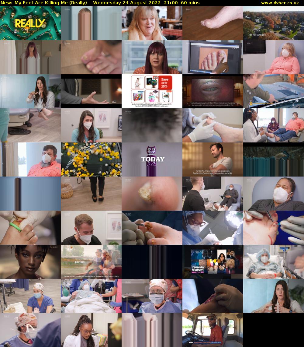 My Feet Are Killing Me (Really) Wednesday 24 August 2022 21:00 - 22:00