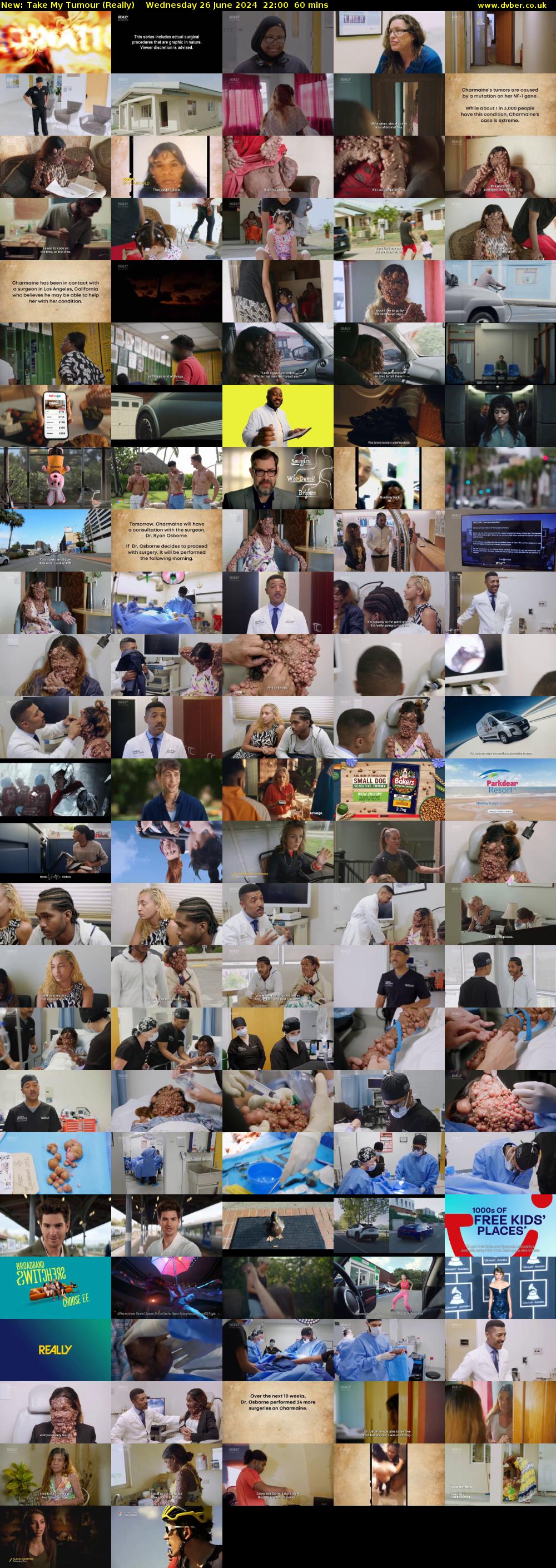 Take My Tumour (Really) Wednesday 26 June 2024 22:00 - 23:00