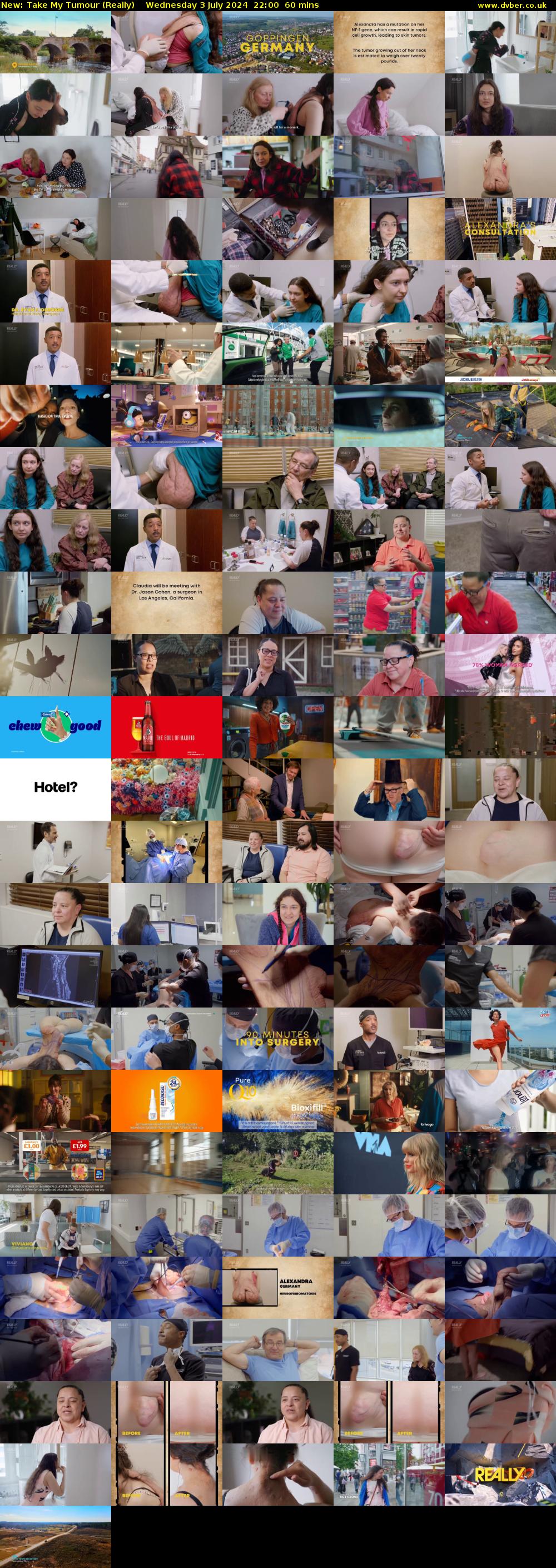 Take My Tumour (Really) Wednesday 3 July 2024 22:00 - 23:00