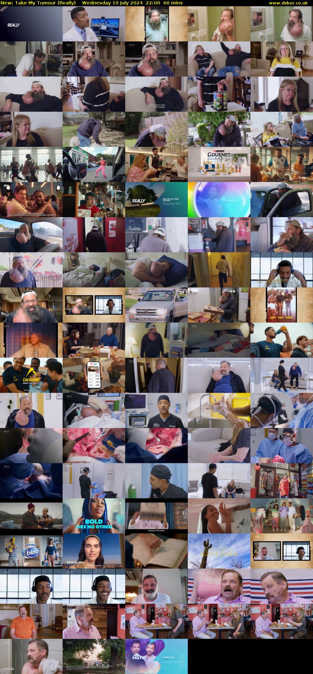 Take My Tumour (Really) Wednesday 10 July 2024 22:00 - 23:00