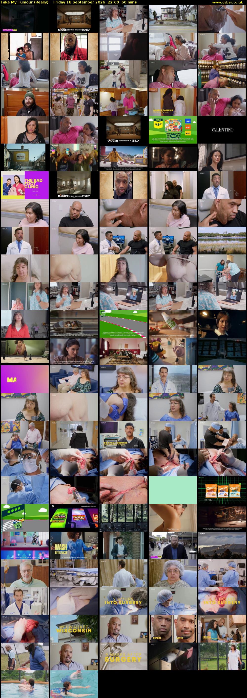 Take My Tumour (Really) Friday 18 September 2026 22:00 - 23:00