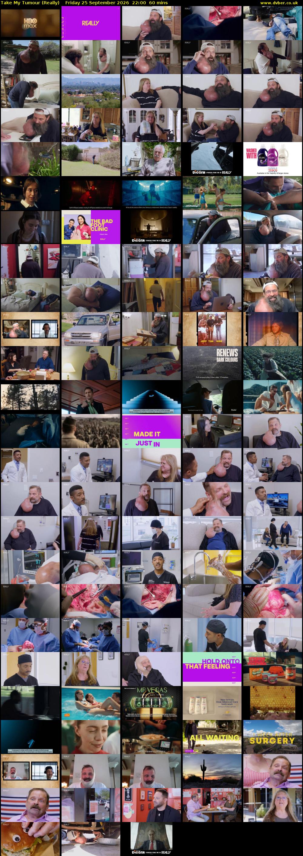 Take My Tumour (Really) Friday 25 September 2026 22:00 - 23:00
