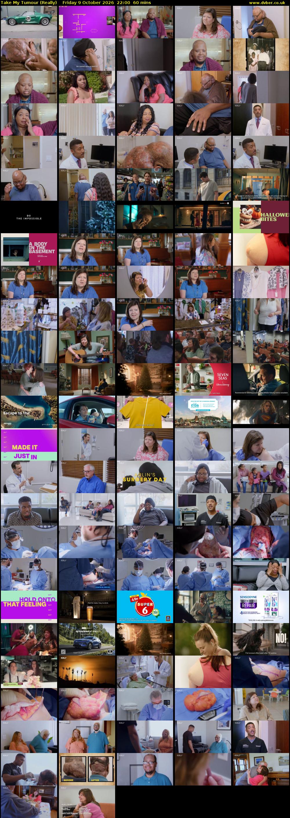 Take My Tumour (Really) Friday 9 October 2026 22:00 - 23:00