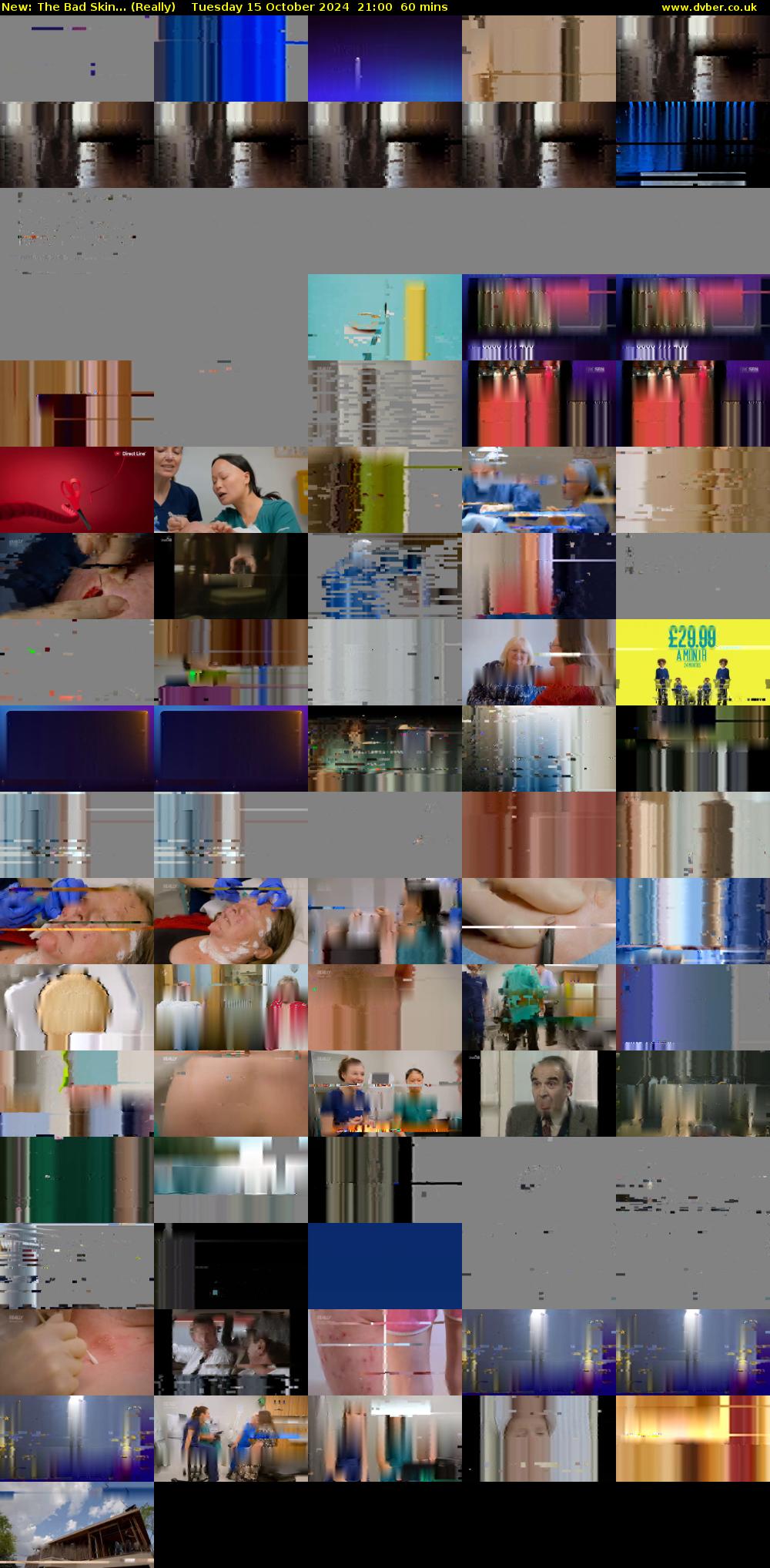 The Bad Skin... (Really) Tuesday 15 October 2024 21:00 - 22:00