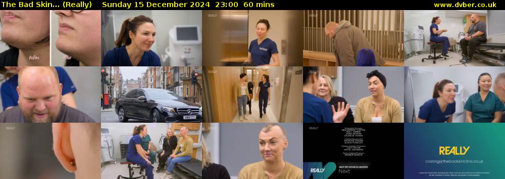 The Bad Skin... (Really) Sunday 15 December 2024 23:00 - 00:00