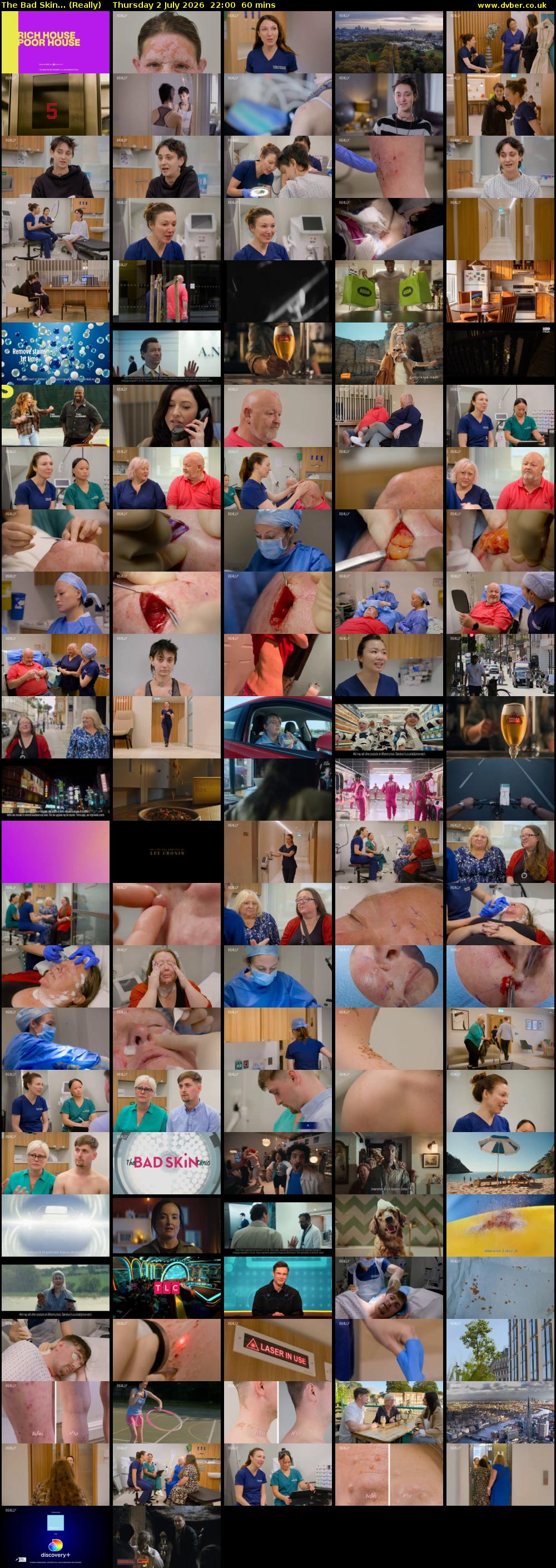 The Bad Skin... (Really) Thursday 2 July 2026 22:00 - 23:00