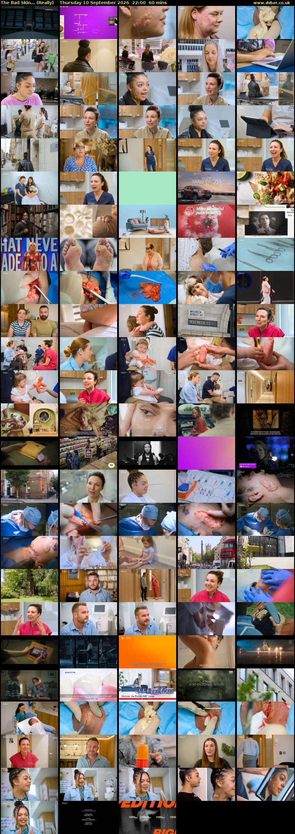 The Bad Skin... (Really) Thursday 10 September 2026 22:00 - 23:00
