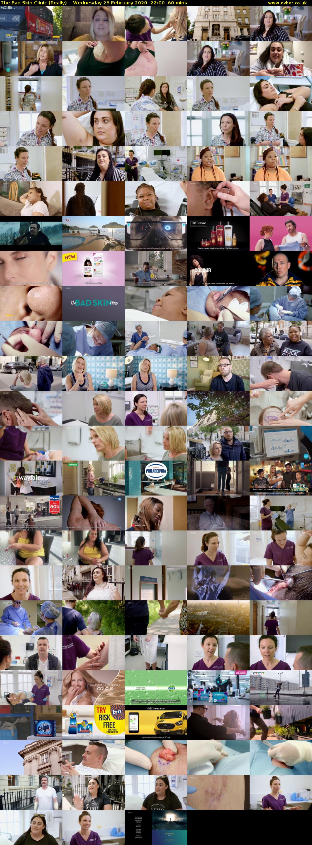 The Bad Skin Clinic (Really) Wednesday 26 February 2020 22:00 - 23:00