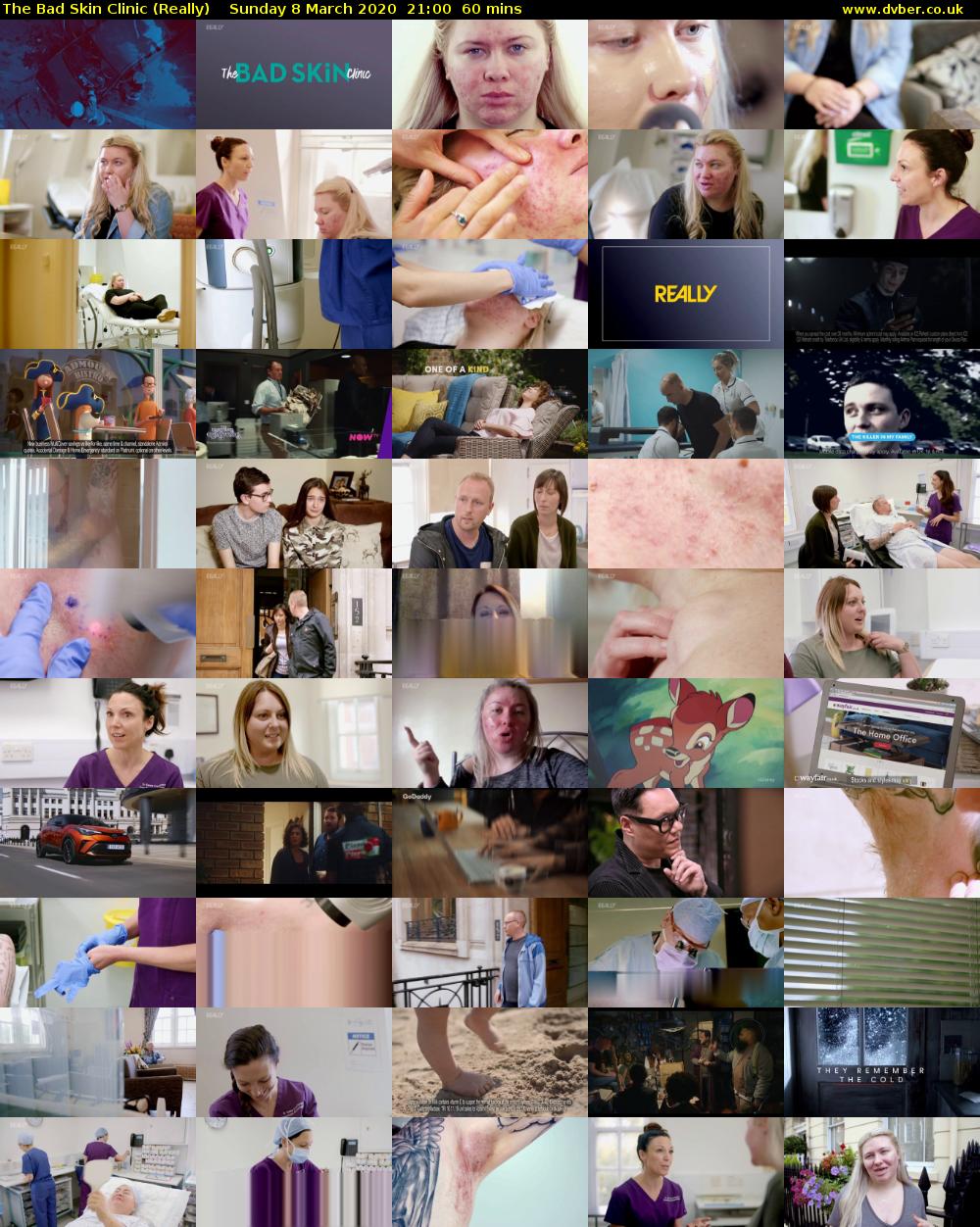 The Bad Skin Clinic (Really) Sunday 8 March 2020 21:00 - 22:00