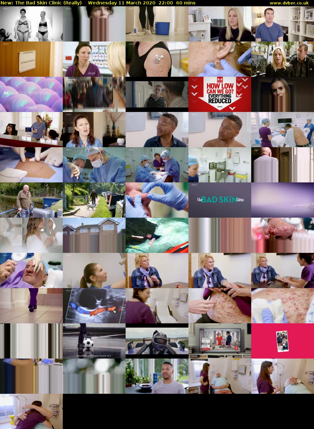 The Bad Skin Clinic (Really) Wednesday 11 March 2020 22:00 - 23:00