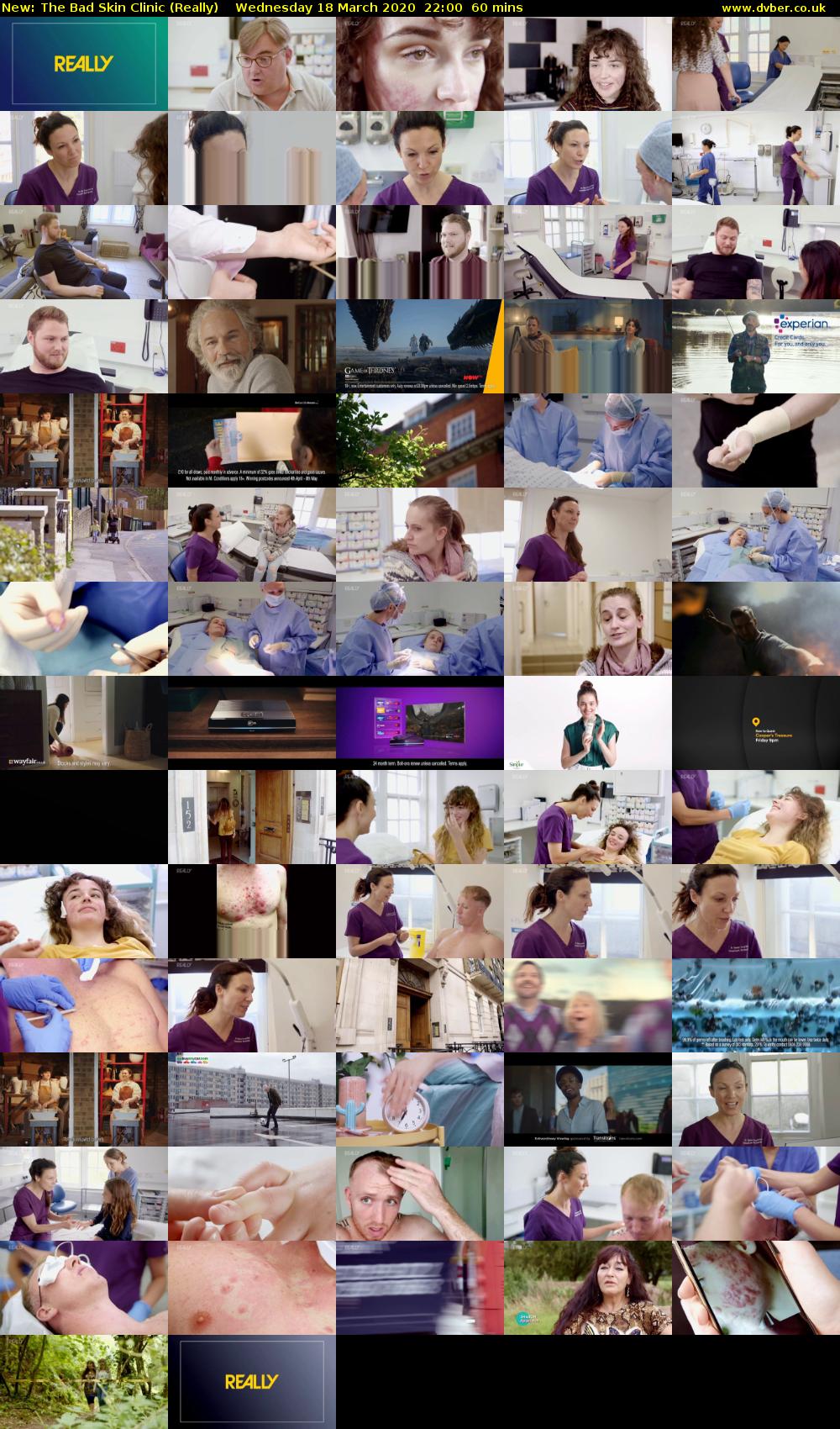 The Bad Skin Clinic (Really) Wednesday 18 March 2020 22:00 - 23:00