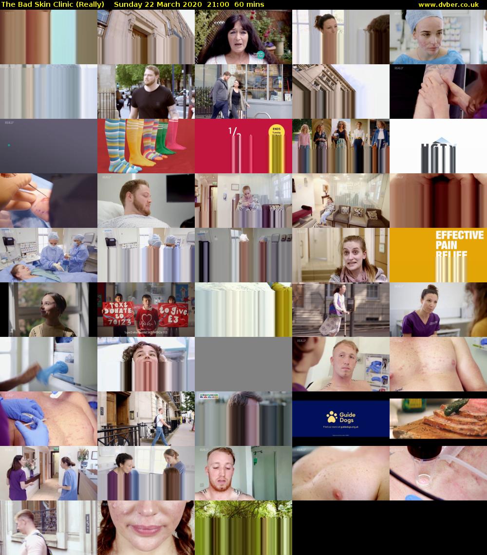 The Bad Skin Clinic (Really) Sunday 22 March 2020 21:00 - 22:00