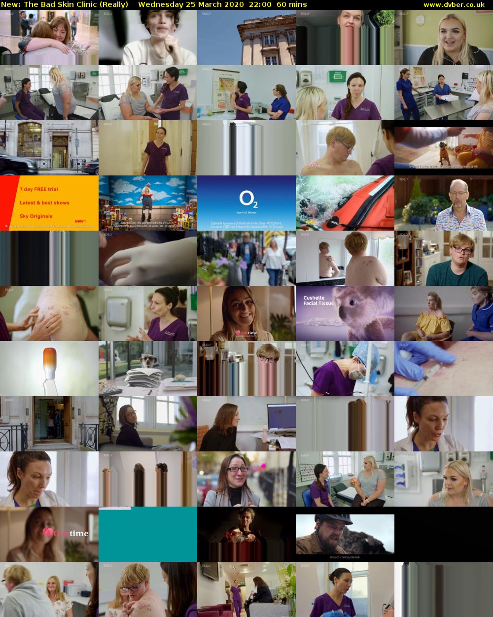 The Bad Skin Clinic (Really) Wednesday 25 March 2020 22:00 - 23:00